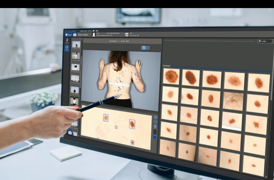 Mosaïque de lésions cutanées analysée sur écran par Bodymapper